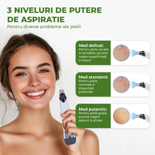 Aparat pentru Puncte Negre Elindor® Aspirator Reglabil, 4 Capete Incluse, 3 Trepte de Viteza, Ingrijirea Tenului, Alb