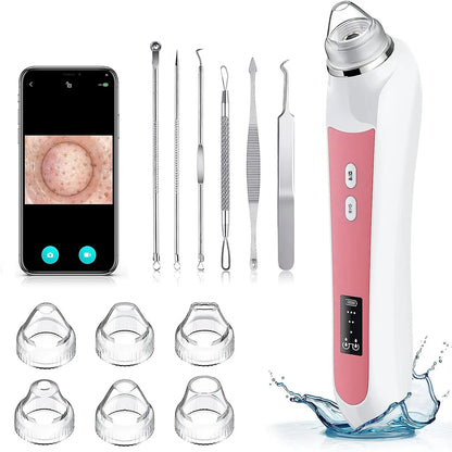 Aspirator Profesional Puncte Negre Elindor® Camera HD 5 MPX, 6 Capete Inter-Schimbabile, 3 Nivele de Putere, Roz