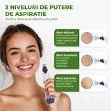 Aparat pentru Puncte Negre Elindor® Aspirator Reglabil, 4 Capete Incluse, 3 Trepte de Viteza, Ingrijirea Tenului, Alb