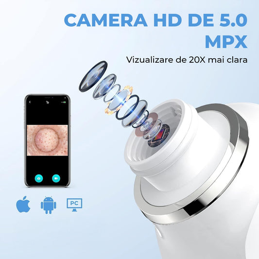 Aspirator Profesional Puncte Negre Elindor® Camera HD 5 MPX, 6 Capete Inter-Schimbabile, 3 Nivele de Putere, Roz