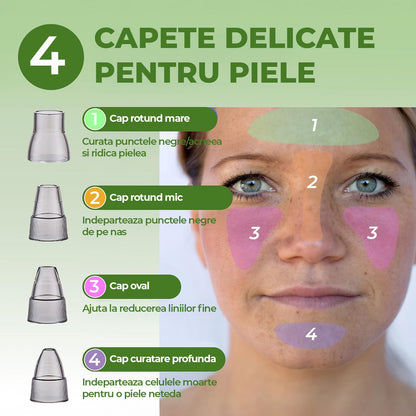 Aparat pentru Puncte Negre Elindor® Aspirator Reglabil, 4 Capete Incluse, 3 Trepte de Viteza, Ingrijirea Tenului, Alb