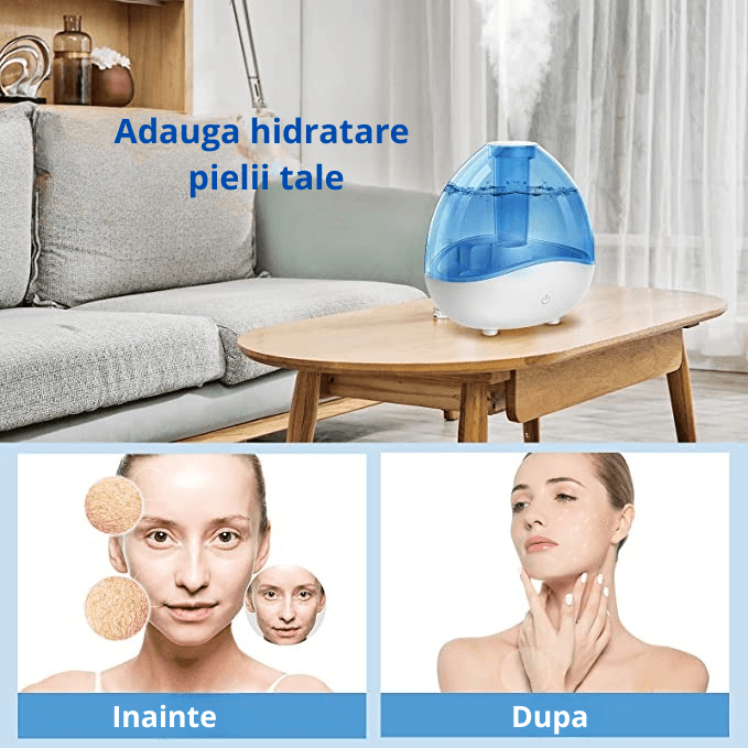 Umidificator Ultrasonic Profesional, 1.5L, Reglabil, Silentios, Alb/Albastru