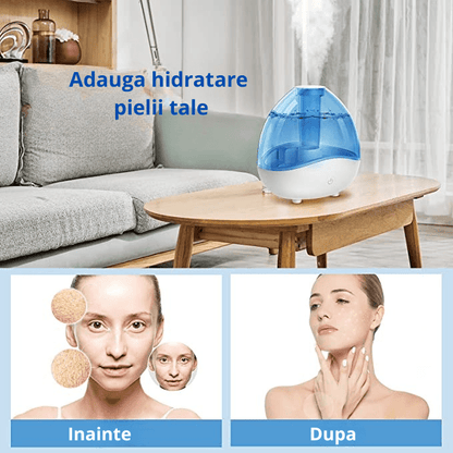 Umidificator Ultrasonic Profesional, 1.5L, Reglabil, Silentios, Alb/Albastru