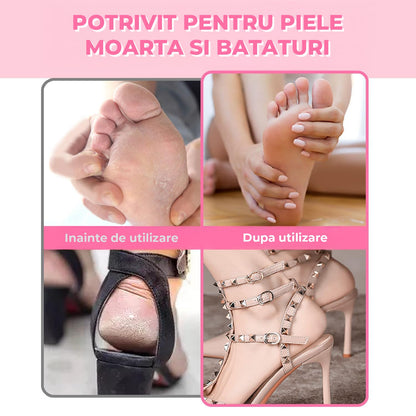 Pila Rotativa Elindor® pentru Calcaie si Talpi, 600 RPM,  Comutator de Viteza, 60 Discuri Smirghel, Piele Crapata si Bataturi, Mov