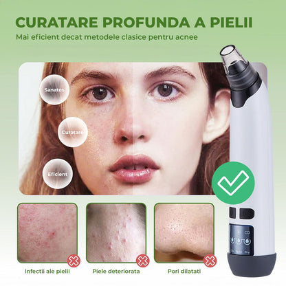 Aparat pentru Puncte Negre Elindor® Aspirator Reglabil, 4 Capete Incluse, 3 Trepte de Viteza, Ingrijirea Tenului, Alb