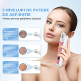 Aspirator Profesional Puncte Negre Elindor® Camera HD 5 MPX, 6 Capete Inter-Schimbabile, 3 Nivele de Putere, Roz