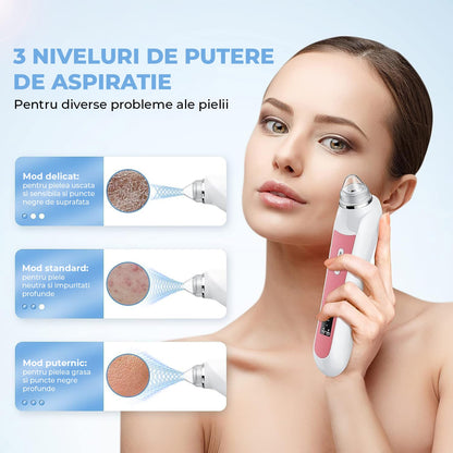 Aspirator Profesional Puncte Negre Elindor® Camera HD 5 MPX, 6 Capete Inter-Schimbabile, 3 Nivele de Putere, Roz