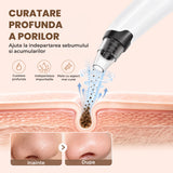 Aparat pentru Puncte Negre Elindor® Aspirator Reglabil, 4 Capete Incluse, 3 Trepte de Viteza, Ingrijirea Tenului, Alb