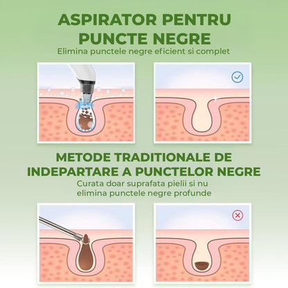 Aparat pentru Puncte Negre Elindor® Aspirator Reglabil, 4 Capete Incluse, 3 Trepte de Viteza, Ingrijirea Tenului, Alb